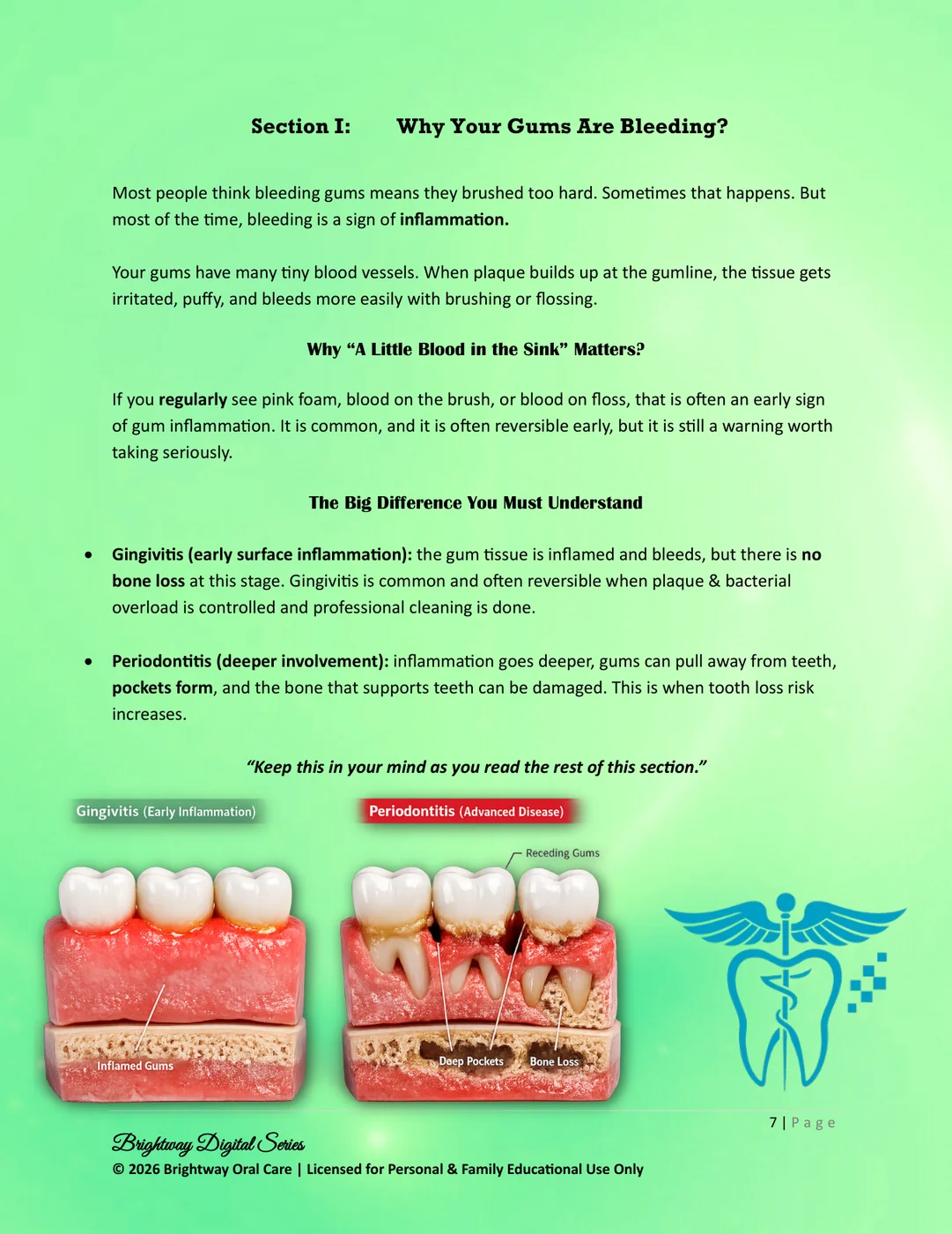 Gingivitis and periodontitis preview